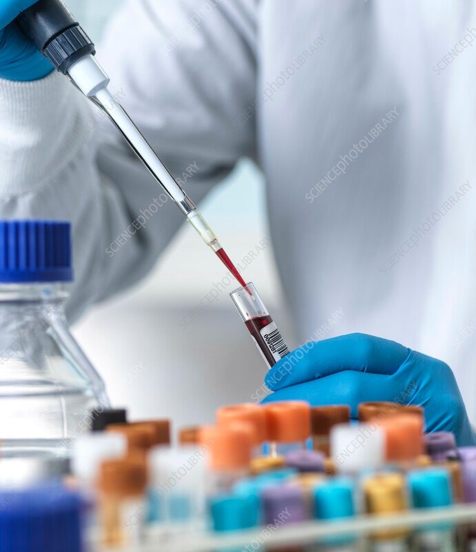 Lab technician analyzing blood samples with pipette