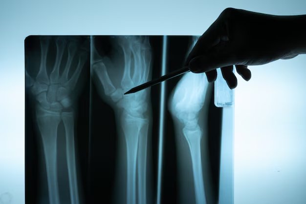 Doctor examining digital X-ray film
